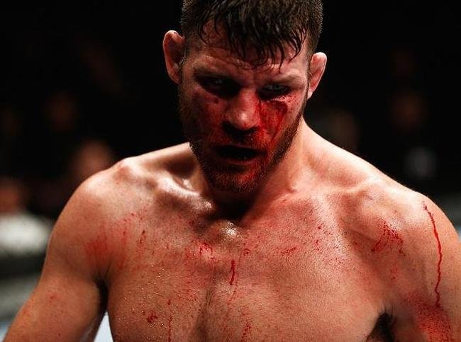 Spider voltou ao UFC com rev�s. Brasileiro chegou a derrubar Bisping com uma joelhada, achou que tinha vencido por nocaute, mas round havia encerrado. No fim, brasileiro acabou perdendo luta por pontos