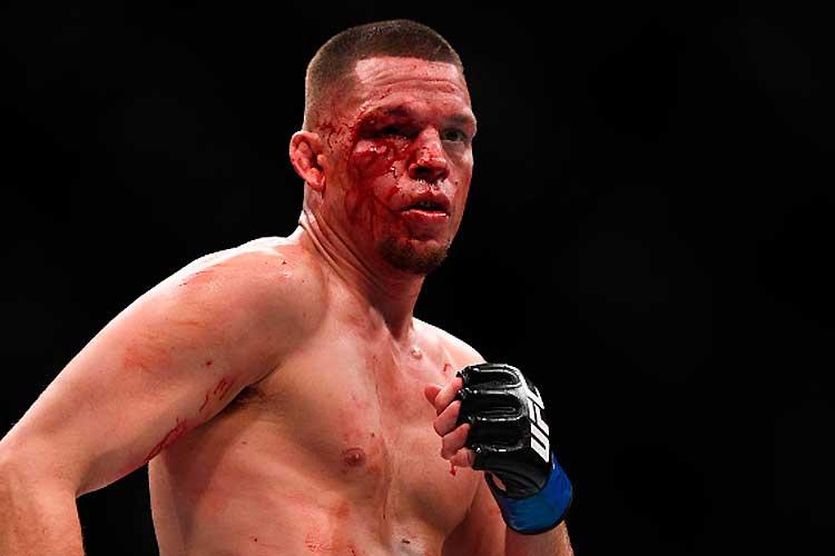 Jeff Bottari/Zuffa LLC/Zuffa LLC via Getty Images