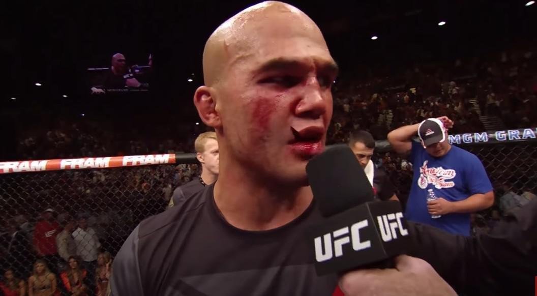 Robbie Lawler sofreu um corte profundo no lbio aps vitria sobre Rory MacDonald na defesa do cinturo dos meio-mdios, em 2015