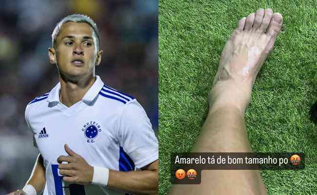 Mateus Vital se lesionou na partida de estreia do Cruzeiro em 2023