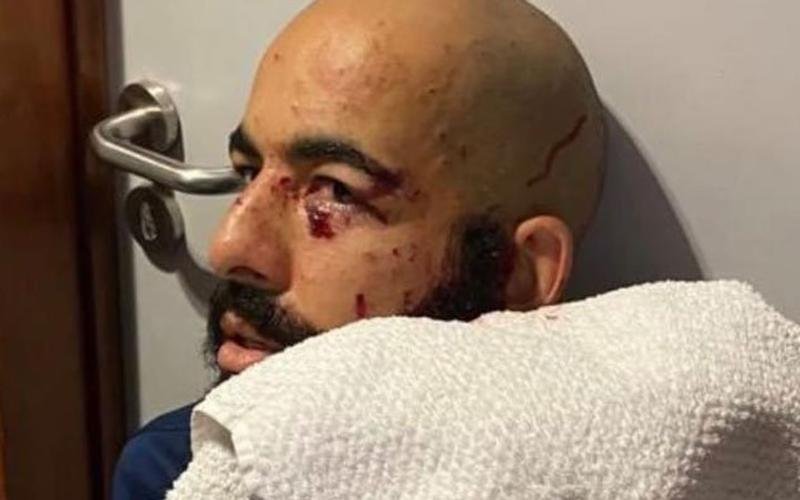 Danilo Fernandes quase foi atingido no olho esquerdo