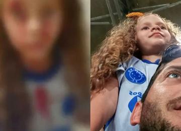 Objeto atingiu em cheio o supercílio da pequena cruzeirense Alicia Danielli Maia Freitas, de 7 anos, de Congonhas, que foi ao Mineirão pela primeira vez