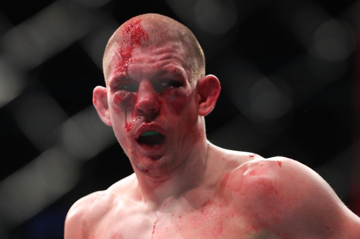 Chris Gruetzemacher venceu Joe Lauzon por nocaute tcnico ao final do 2 round