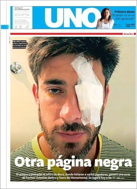 UNO - Outra pgina negra