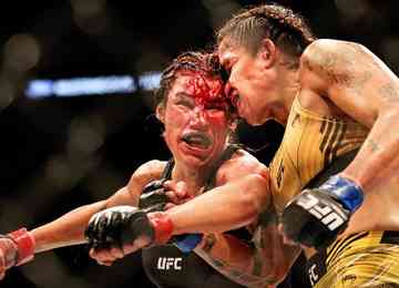 De acordo com Dana White, mandatário do UFC, lutadora precisaria ver cirurgião plástico após lesões no rosto em derrota para a brasileira