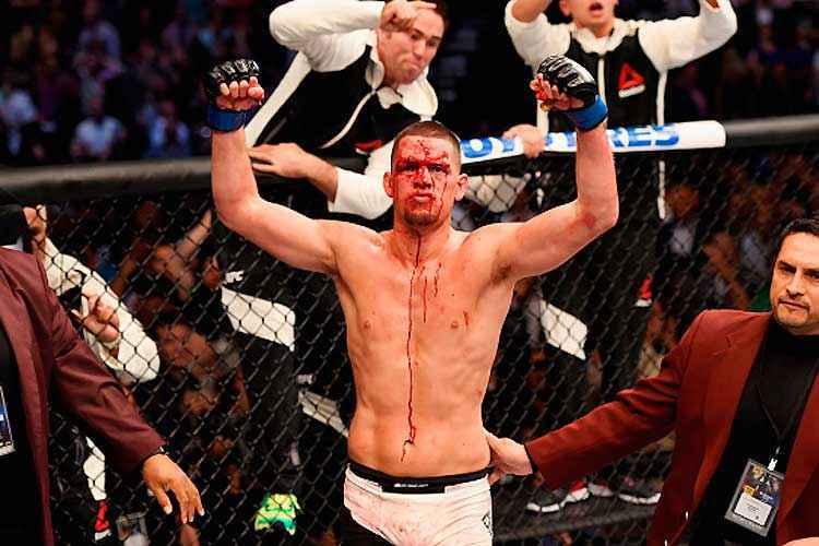 Josh Hedges/Zuffa LLC via Getty Images