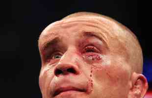 Matt Homenick ficou com enormes galos na testa e cortes nos olhos após derrota para José Aldo, em 2011, valendo o cinturão do peso pena