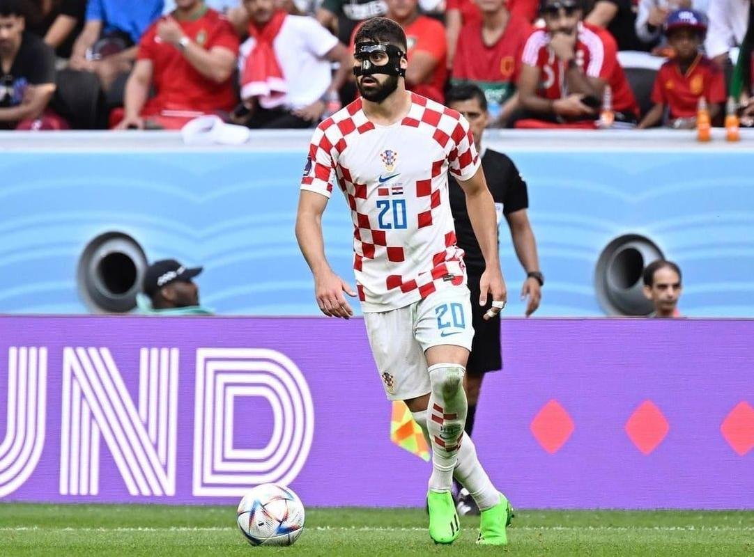 9. Gvardiol (R$ 717 milhes)
