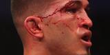 Fotos da vitria de Rafael dos Anjos, que valeu o cinturo dos leves do UFC