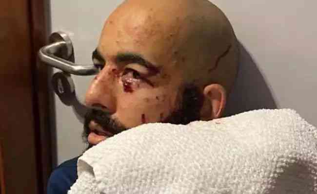 Danilo Fernandes sofreu ferimentos no rosto e em outras partes do corpo, mas olho  preocupao