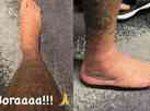 Neymar, da Seleo Brasileira, posta foto do tornozelo inchado