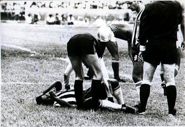 Copa do Mundo de 1978 (Argentina) - Com os problemas crônicos no joelho, o atacante atleticano Reinaldo chegou 'baleado' para a Copa. Marcou apenas um gol, na estreia contra a Suécia, e jogou no sacrifício outras duas partidas. Após o Mundial, teve que ser submetido a nova cirurgia.