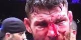 Derrota de Anderson Silva para Michael Bisping, em Londres, deu margem para brincadeiras na internet