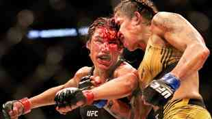 'Atropelada' por Amanda Nunes no UFC, Pe�a perdeu peda�o da testa na luta