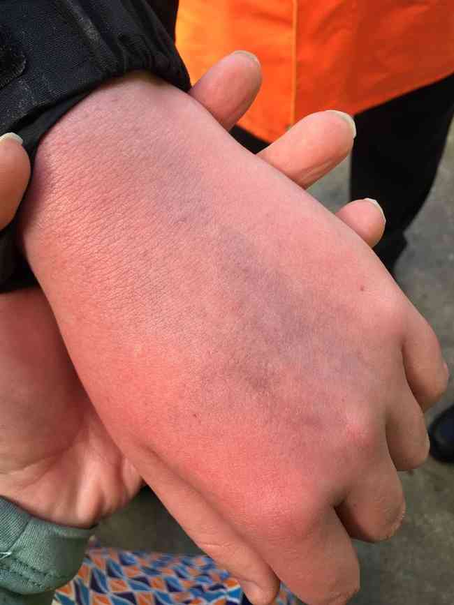 Sarah Kelly divulgou foto de como ficou o estado da mão de seu filho após o tapa de Cristiano Ronaldo