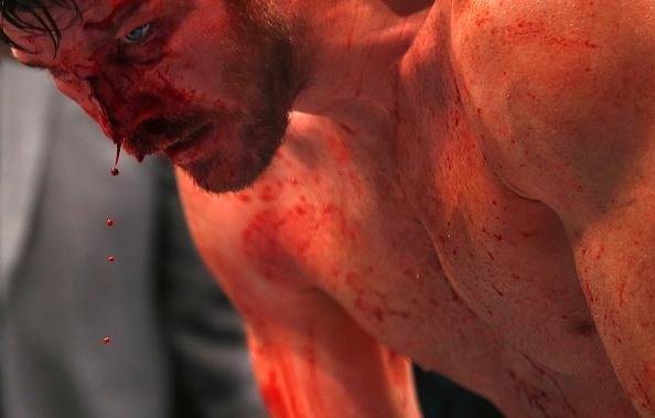 Spider voltou ao UFC com revés. Brasileiro chegou a derrubar Bisping com uma joelhada, achou que tinha vencido por nocaute, mas round havia encerrado. No fim, brasileiro acabou perdendo luta por pontos